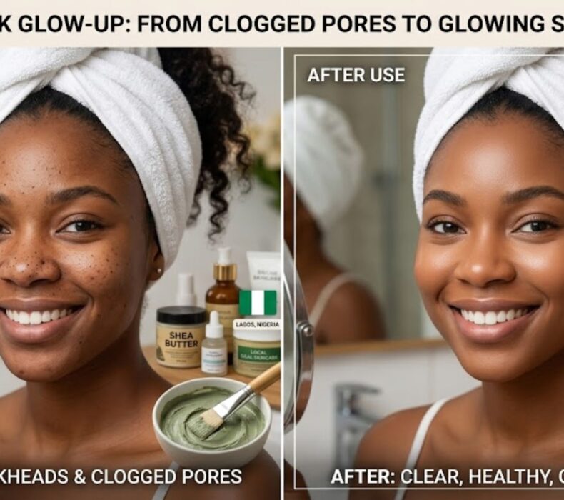 Best Clay Mask for Blackheads and Clogged Pores in Nigeria